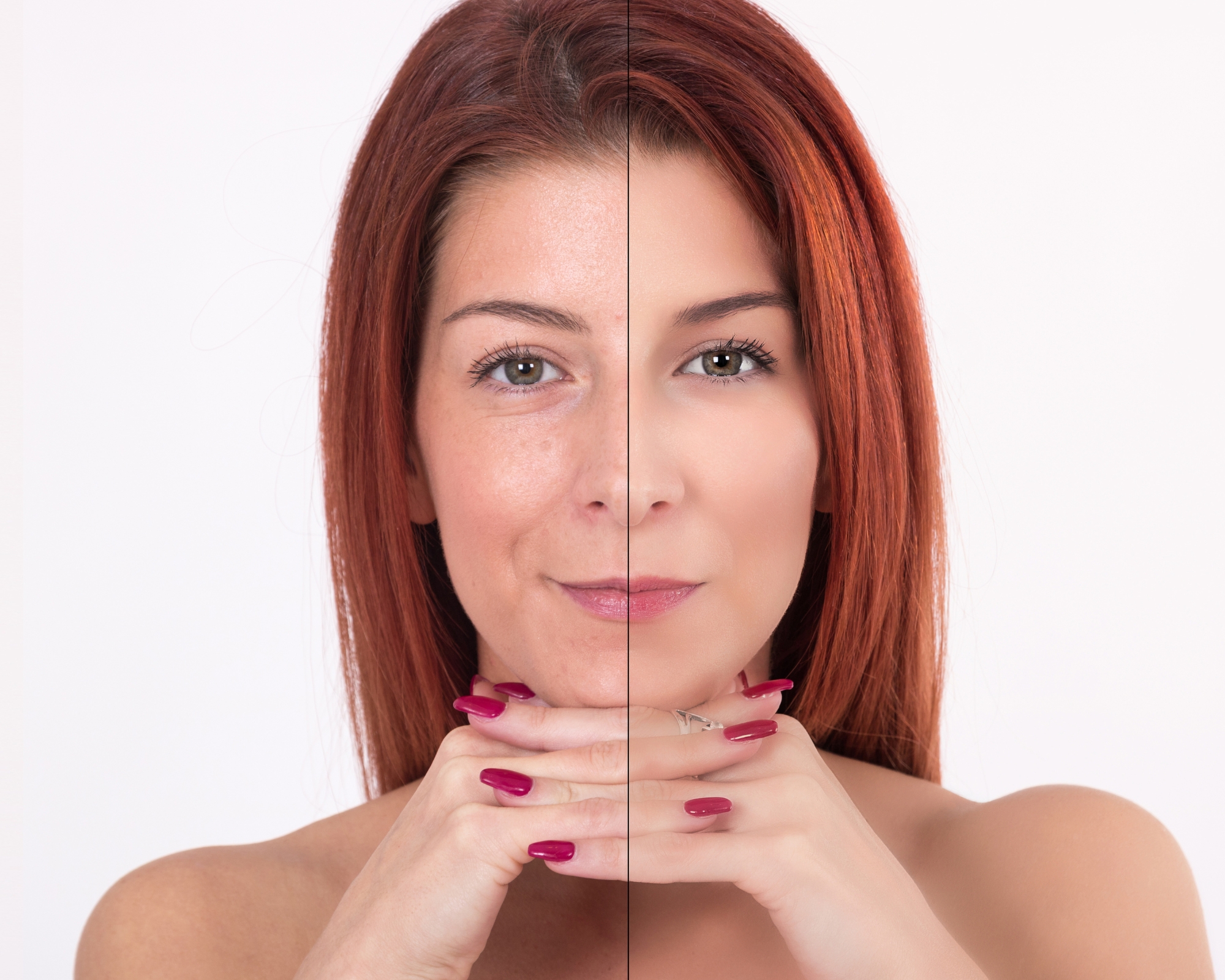 benefícios do colágeno para pele antes e depois