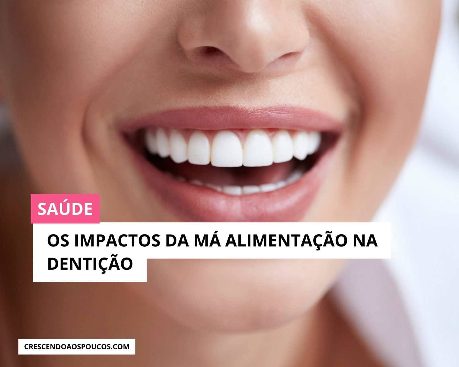 Impactos da má alimentação na dentição: guia preventivo